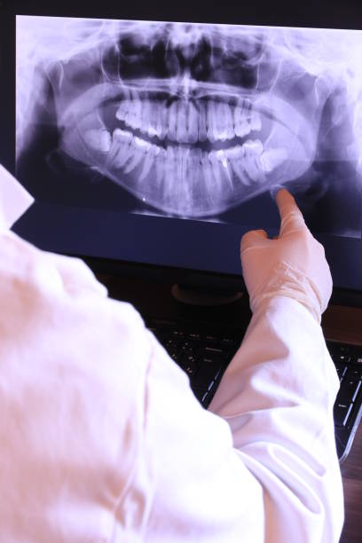 Best Dentist for Tooth Abscess  in Oliver Springs, TN