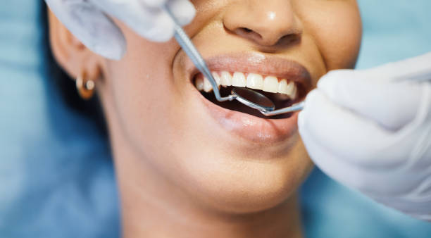 Best Emergency Dental Filling Replacement  in Oliver Springs, TN