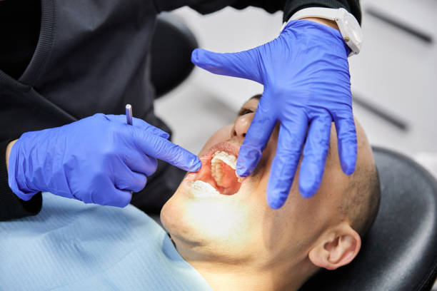Best Teeth Whitening  in Oliver Springs, TN